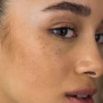 മുഖത്തെ കറുത്ത പാടുകള് മാറ്റാം pjimage–4-_710x400xt