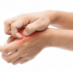 ശുക്ളത്തിനോടുള്ള അലർജിയെക്കുറിച്ച് അറിയാം shutterstock-555486850