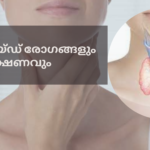 തൈറോയ്ഡ് രോഗങ്ങളും ഭക്ഷണവും thiorid